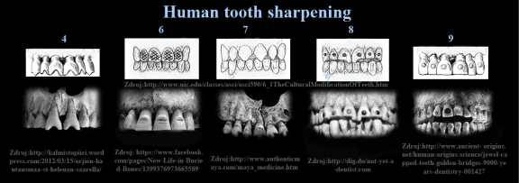 11 Úpravy zubů typické pro Mayskou kultůru.png