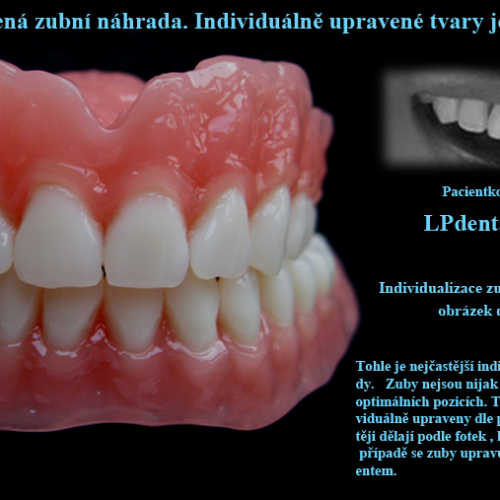 1 Standardně postavená zubní náhrada.Individuálně upravené tvary jednotlivých zubů..png
