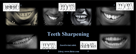2 Teeth Sharpening-typy zbroušení zubů.png