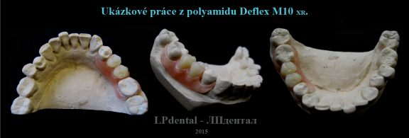 15 Ukázkové práce z polyamidu Deflex M10 (Nuxen S.r.l.) pro firmu Complete Dental.png