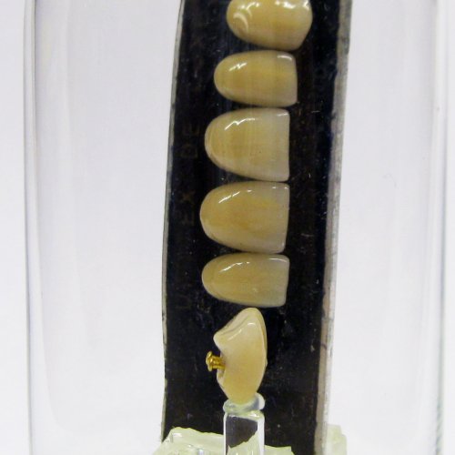 Uran-U-Uranium Containing Dentures ca.1950 Ceramic teeth with gold-plated pins. 10.jpg